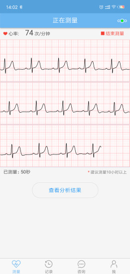 数维康心电官方版2