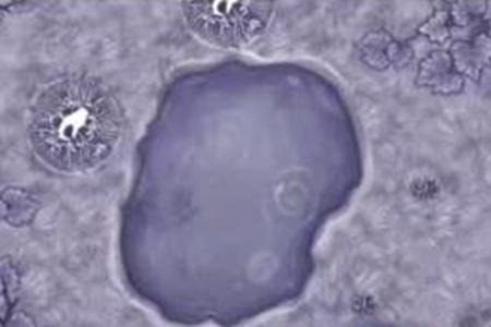 阿瑞斯病毒2曼陀罗花位置介绍